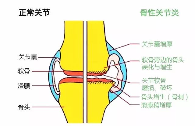 股四头肌训练椅子_股四头肌训练椅使用方法_股四头肌训练椅
