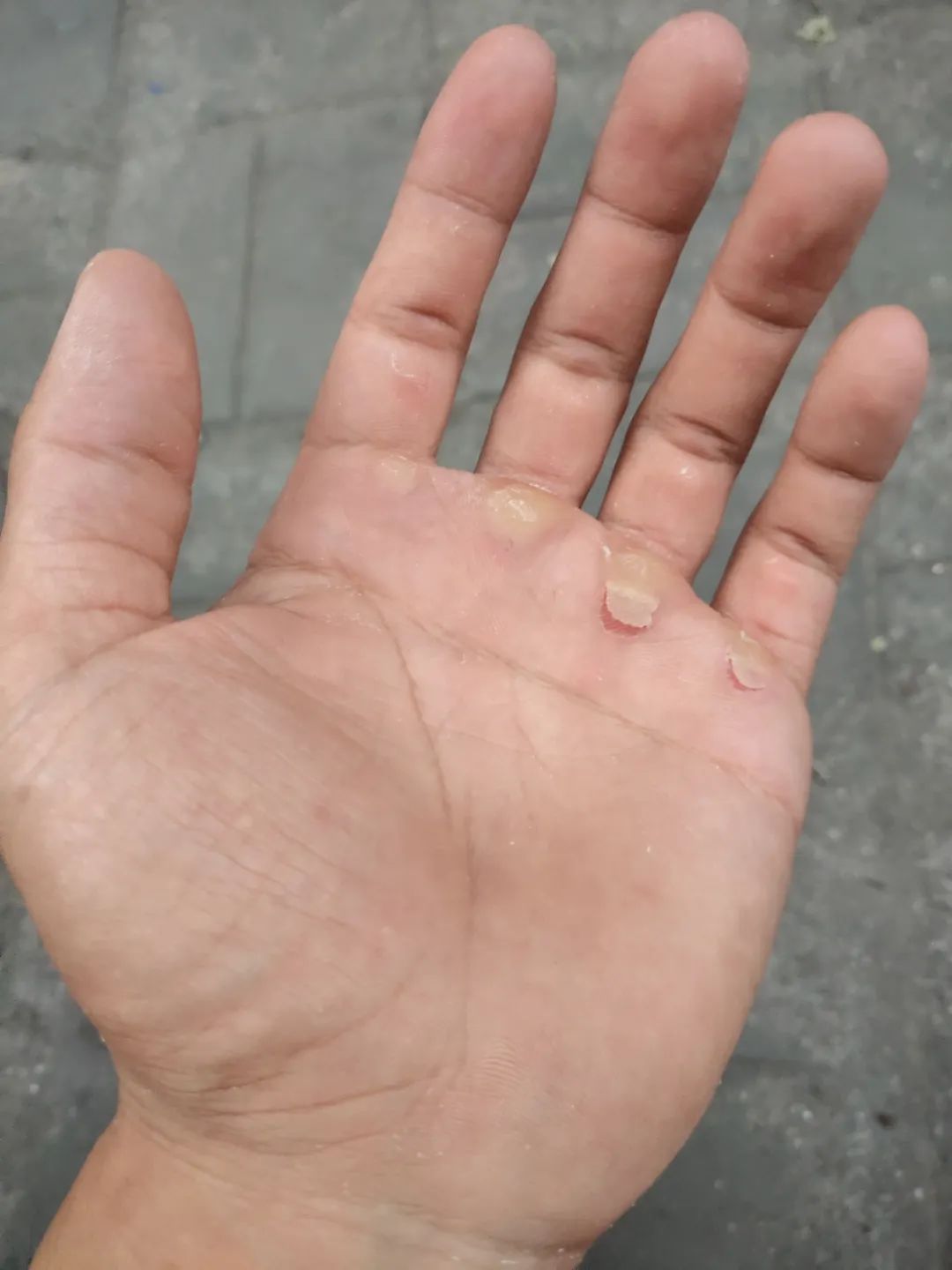 手套健身老茧怎么去掉_健身手套防起茧_健身手套老茧