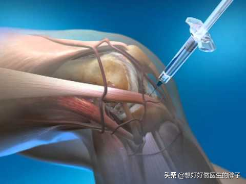 股四头肌训练椅安装视频_股四头肌训练椅_股四头肌训练椅安装步骤