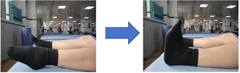 yy漫画画免费读漫画下拉式阅读网页 髋关节置换后，康复训练这样做，让身体恢复更快！