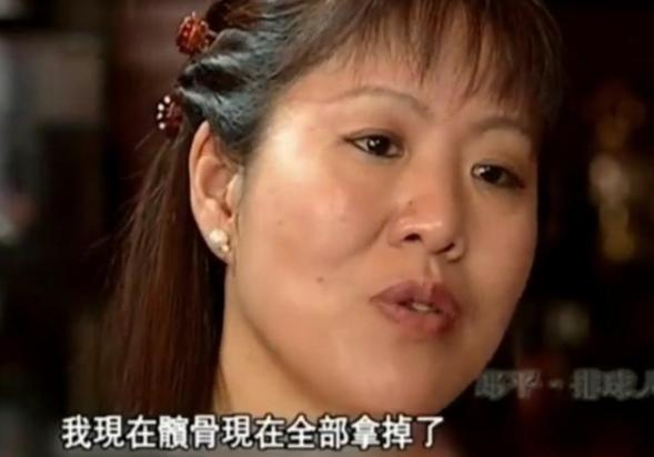髋关节训练椅_髋关节训练器的适应症_髋关节训练椅的用途
