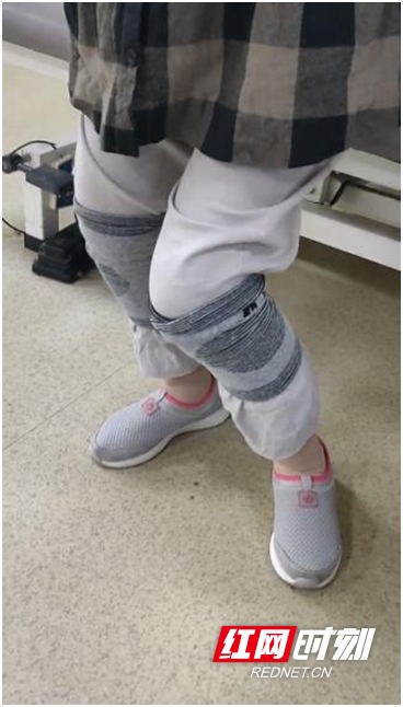 膝过伸 康复治疗 中风后遗症_股四头肌训练椅