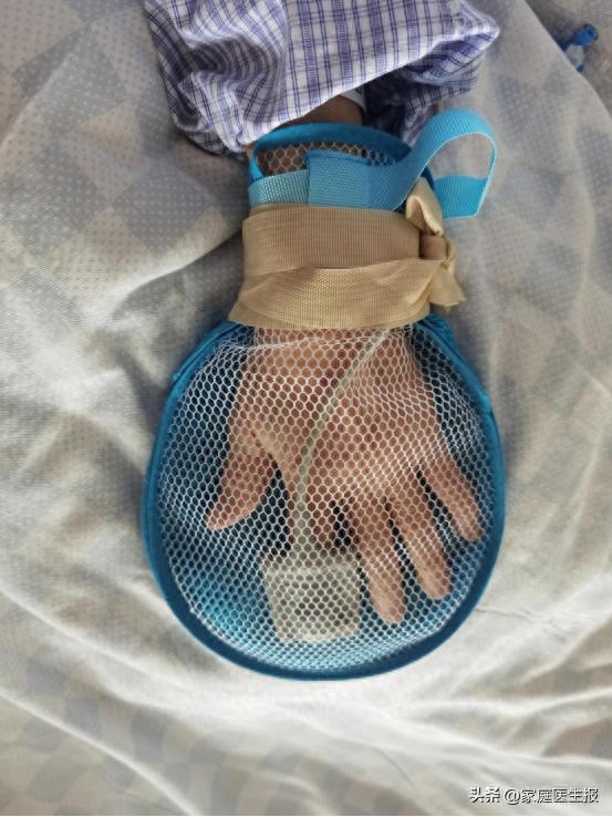 开yun体育官网入口登录体育 巧用约束手套，预防非计划拔管